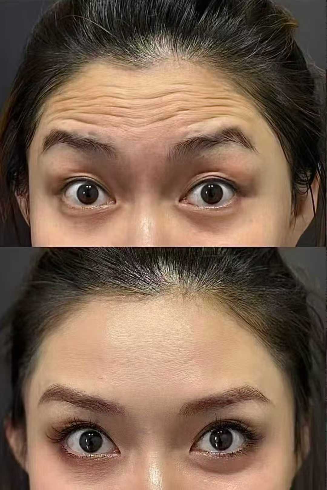 Transformation 1