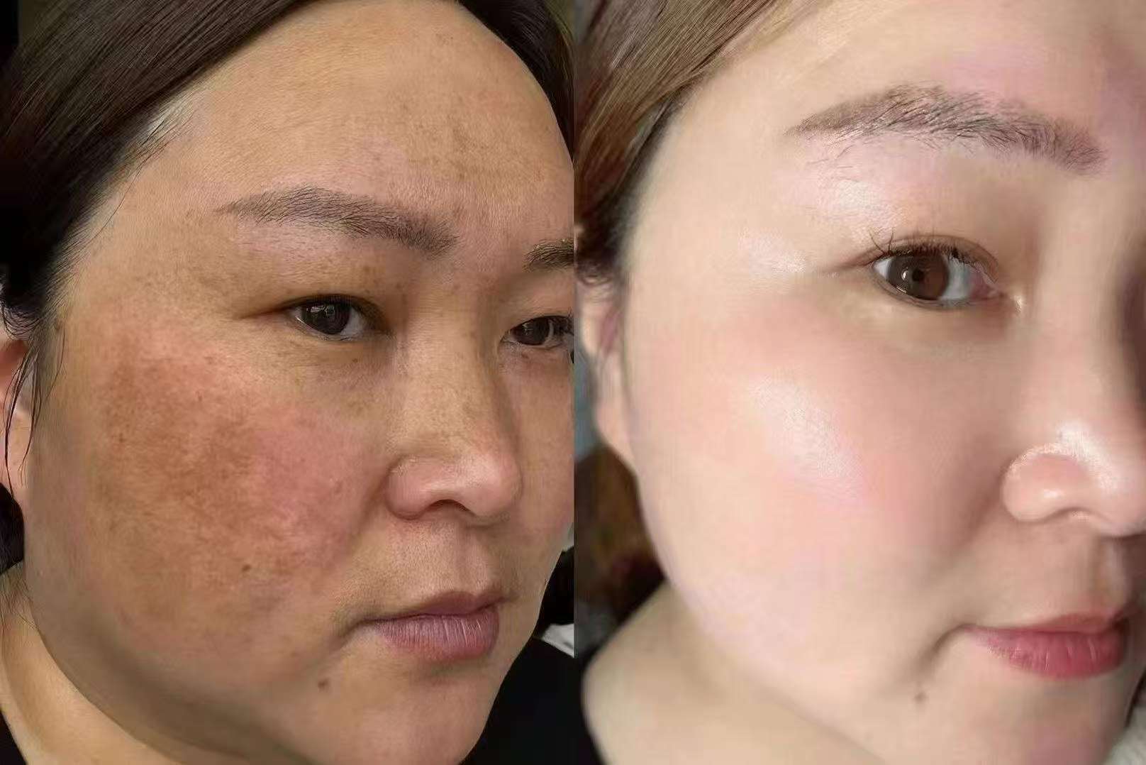 Transformation 2
