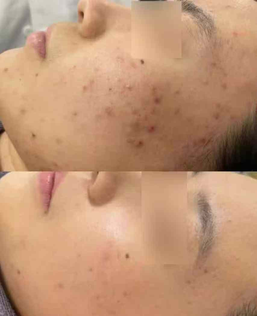 Transformation 4