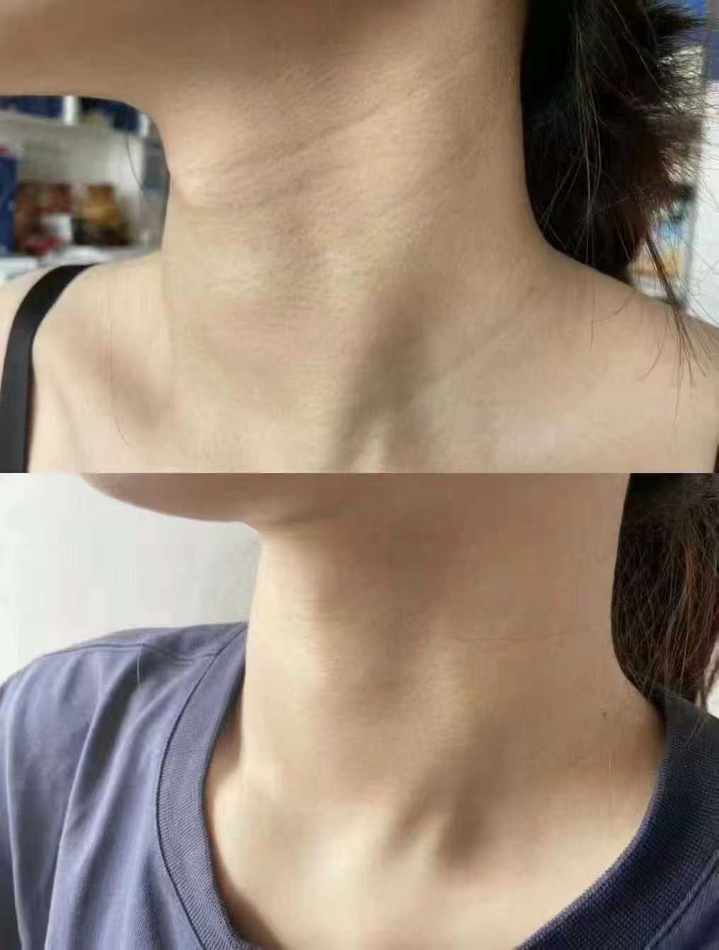 Transformation 6